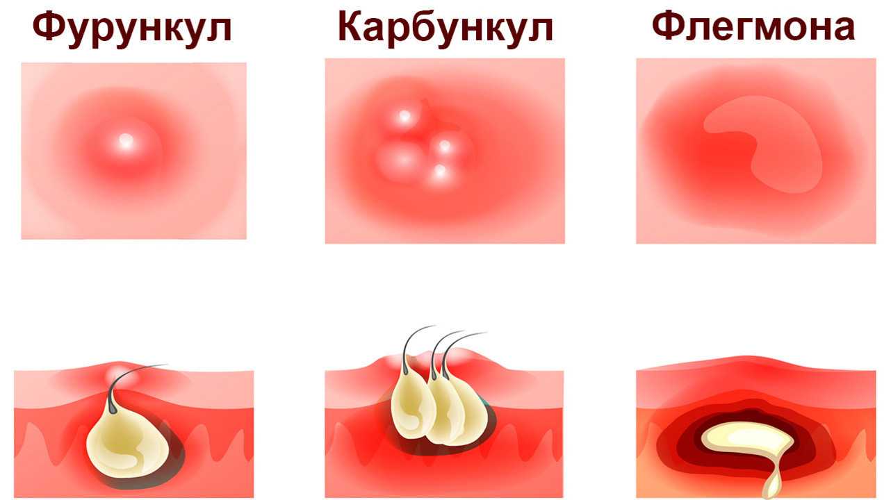 Абсцесс у собак
