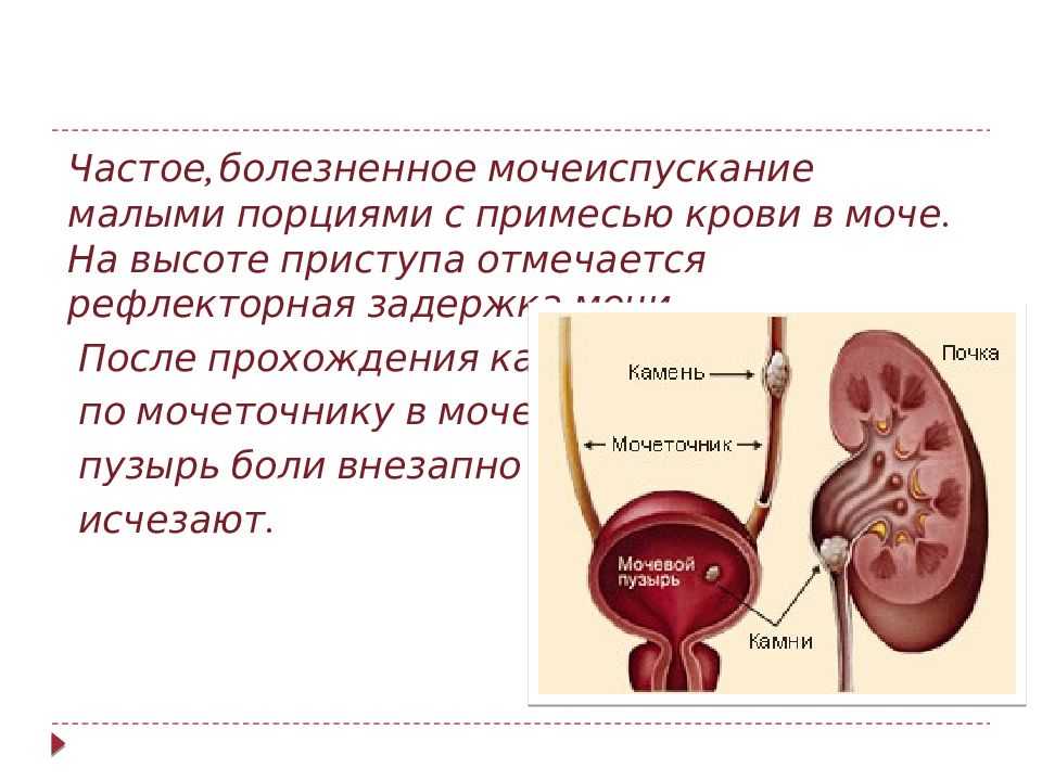 Урологические расстройства -