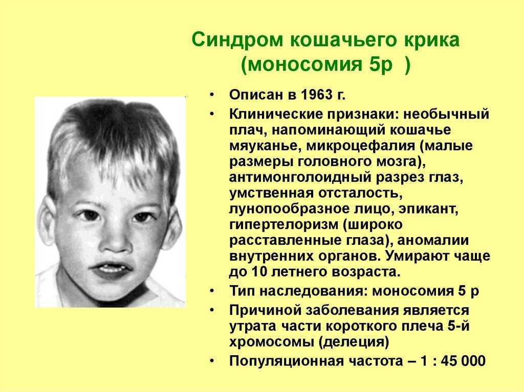 У кошек может быть синдром дауна? lowdown на кошачьих ds