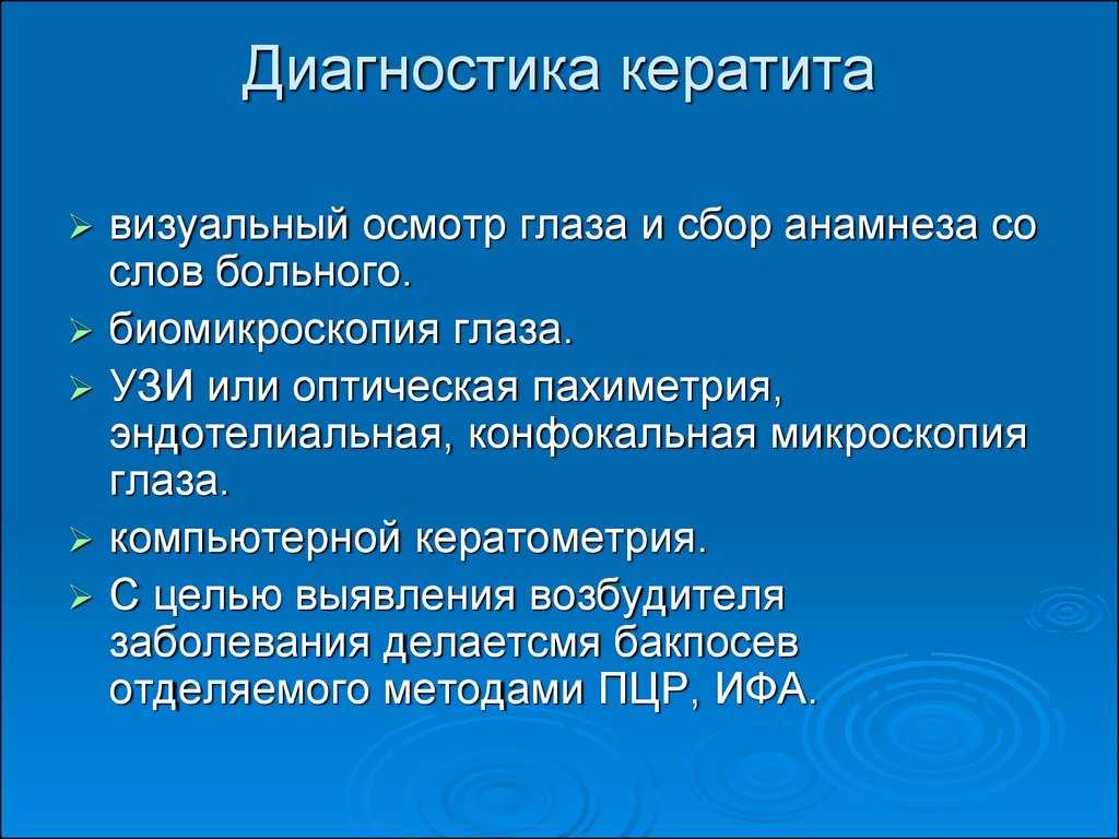 Лечение кератита. Методы диагностики кератитов. Кератиты классификация диагностика. План обследования больного кератитом.