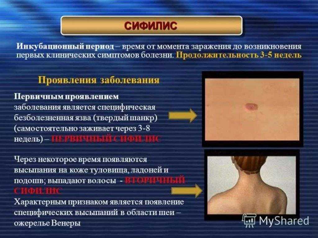 Лишай у ребенка - симптомы, диагностика и лечение | детский дерматолог см-клиника
