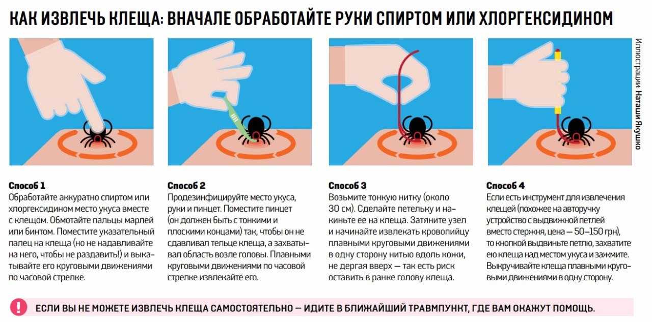 Обработка места. Как вытащить клеща с помощью нитки. Как достать клеща с помощью нитки. Как правильно извлечь клеща. Как вытащить клеща у человека в домашних условиях.