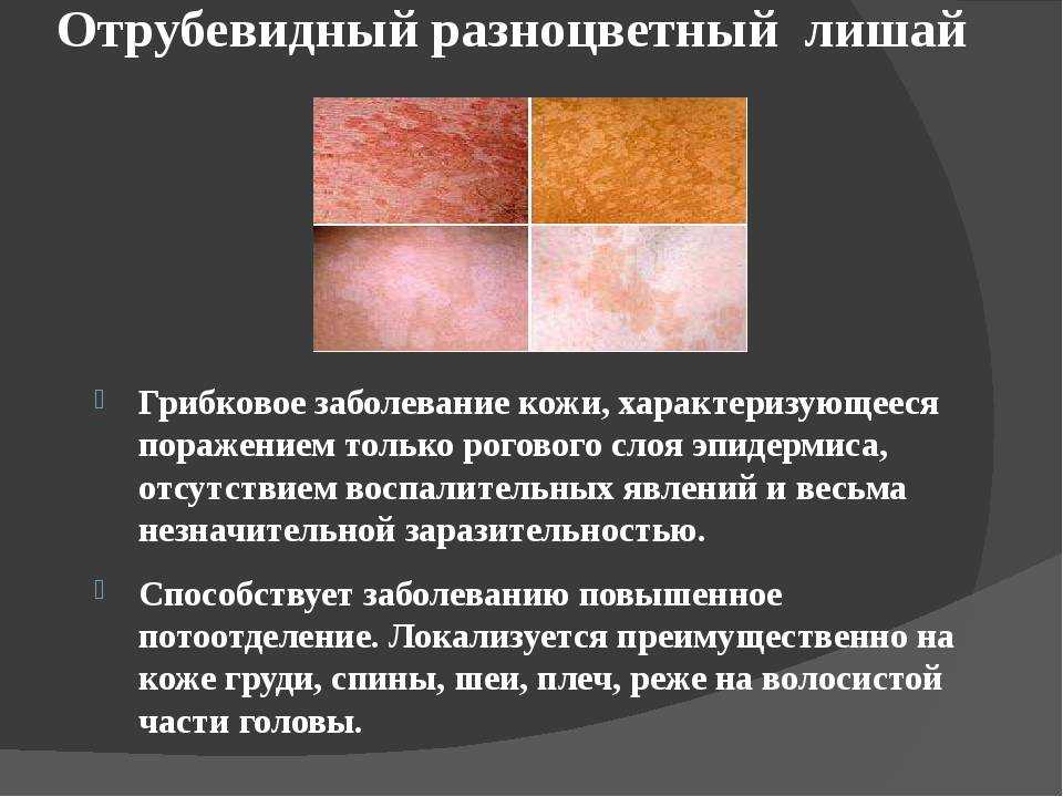 Описание видов опухолей и методов лечения