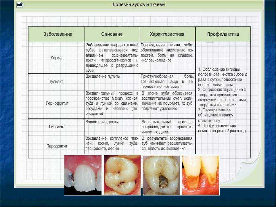Заболевания зубов и полости. Заболевание зубов таблица. Таблица по заболевания зубов.