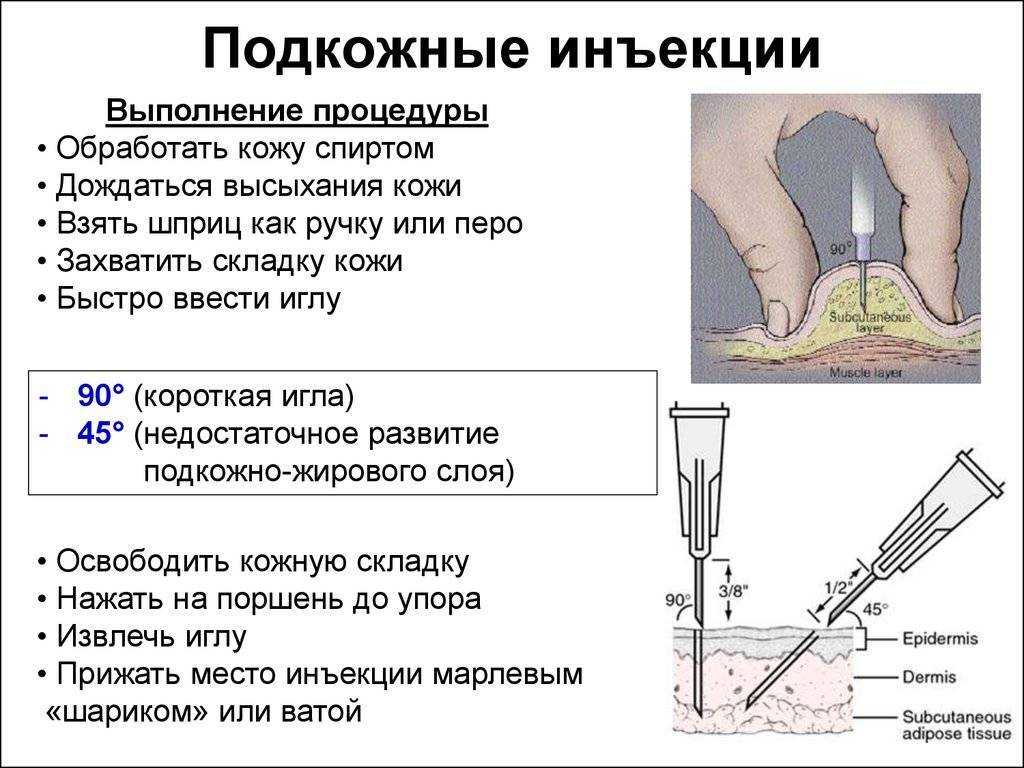 Как правильно делать укол в руку внутримышечно фото пошагово