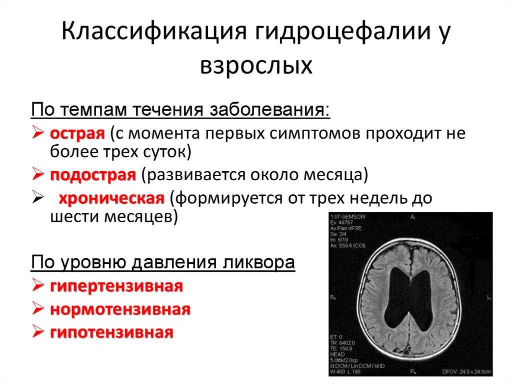 Лечится ли гидроцефалия у собак