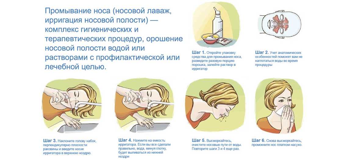 Промывание носа руками. Правильная техника промывания носа. Как промыть нос солью с водой в домашних условиях. Промывание носа носовой лаваж. Как правильно промывать нос солевым раствором в домашних условиях.