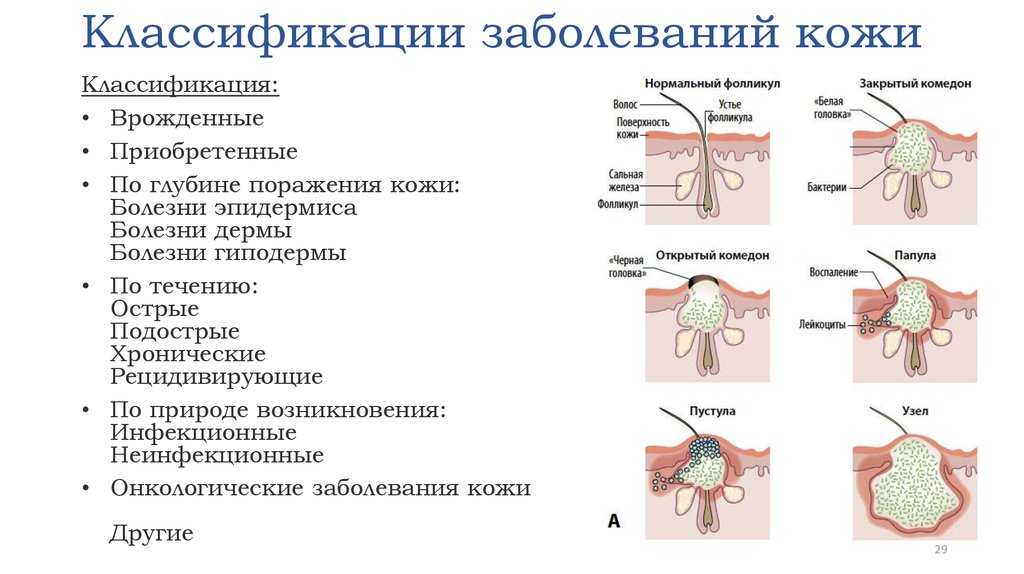 Болезни кожи у кошек. как проявляются и чем лечить, диагностика +фото и видео