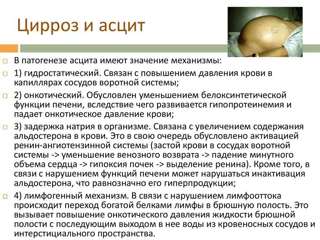 асцит симптомы у женщин