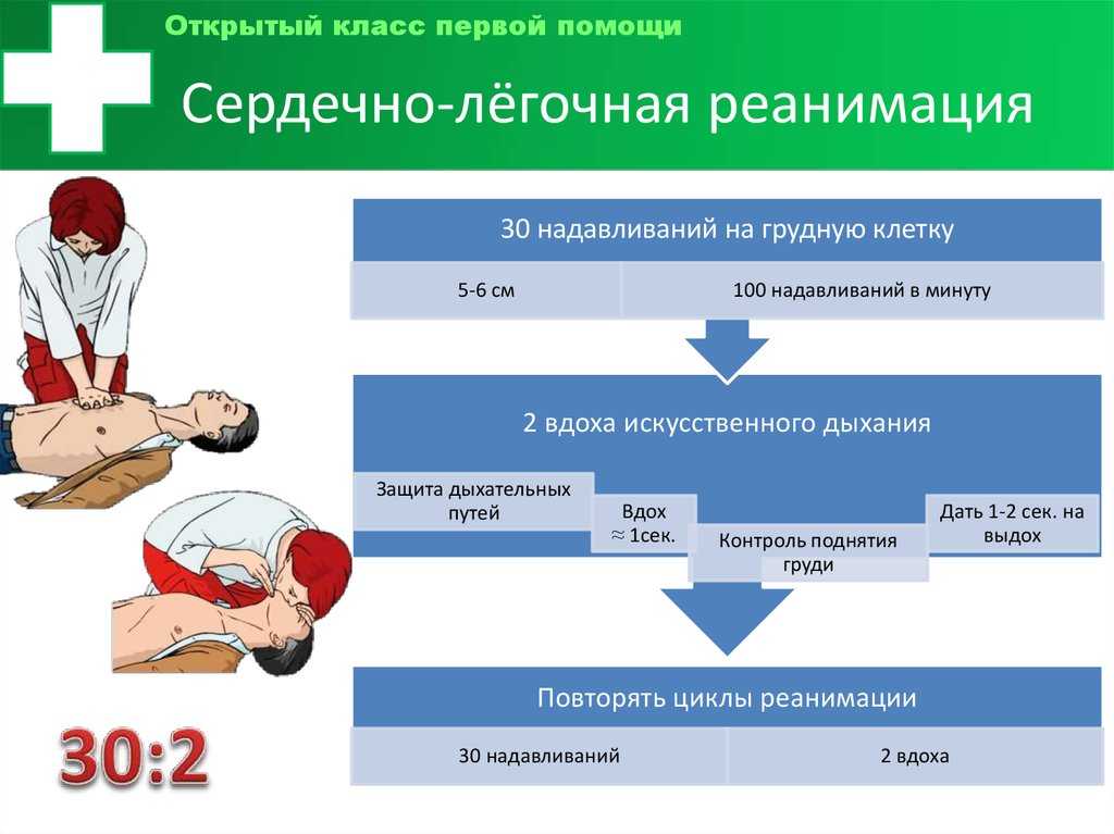 Дополните схему оказания экстренной реанимационной помощи