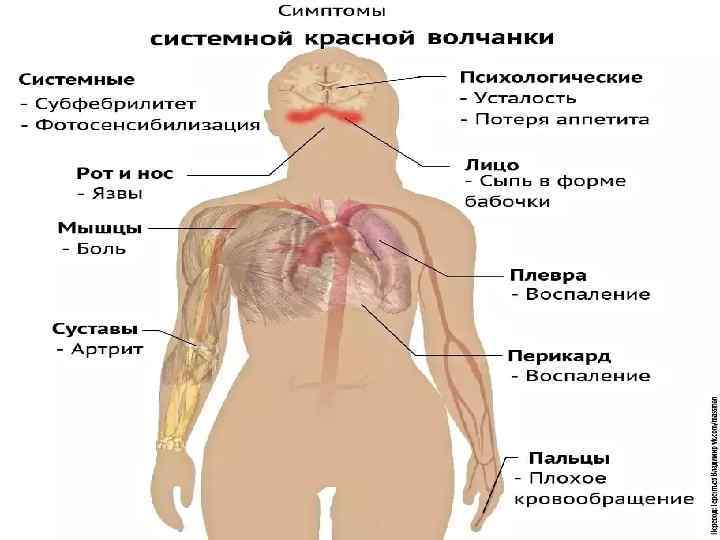 Красная волчанка у собак: фото, что за болезнь, симптомы и лечение