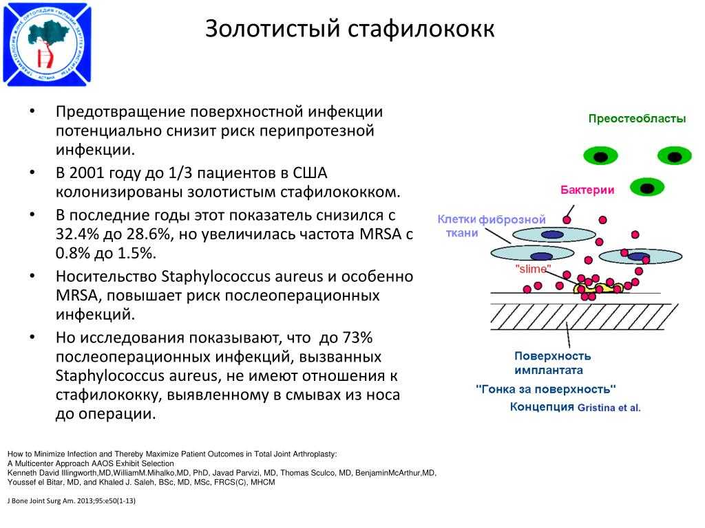 Воспаление матки: особенности и виды, признаки воспаление матки, диагностика и лечение | патологии | апиценна