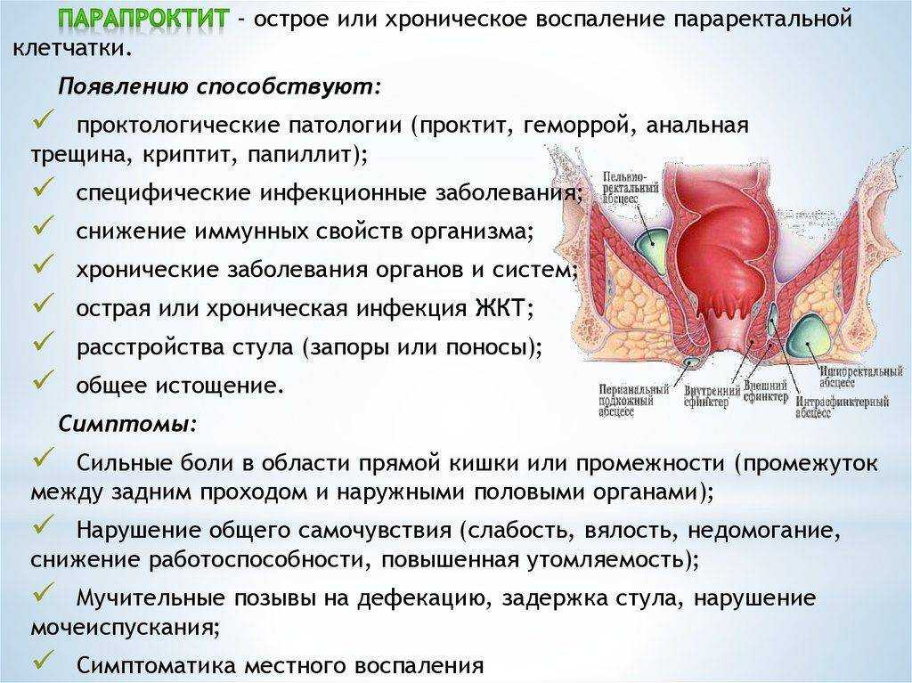 Геморрой: причины, симптомы и способы лечения разных видов и стадий геморроя