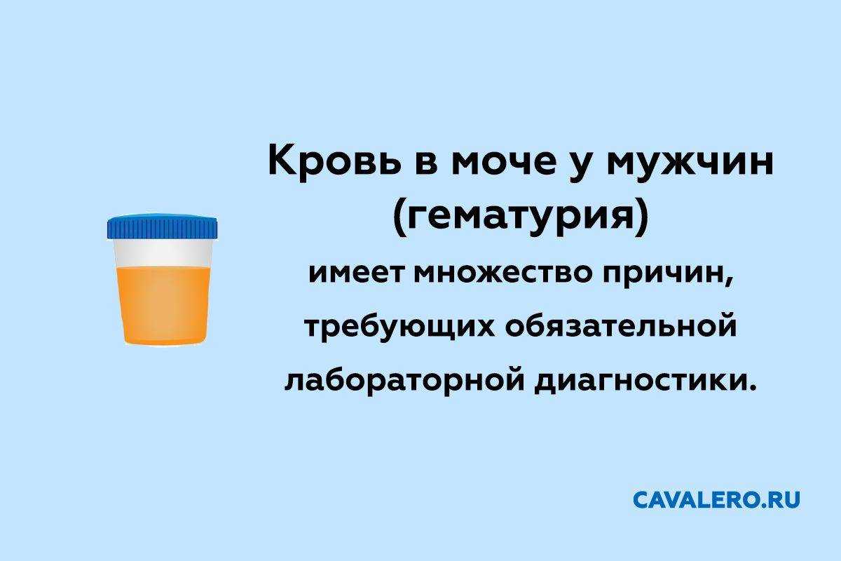 Боли в мочи. Моча с кровью у мужчин причины. Гематурия у мужчин. Кровь при мочеиспускании у мужчин.