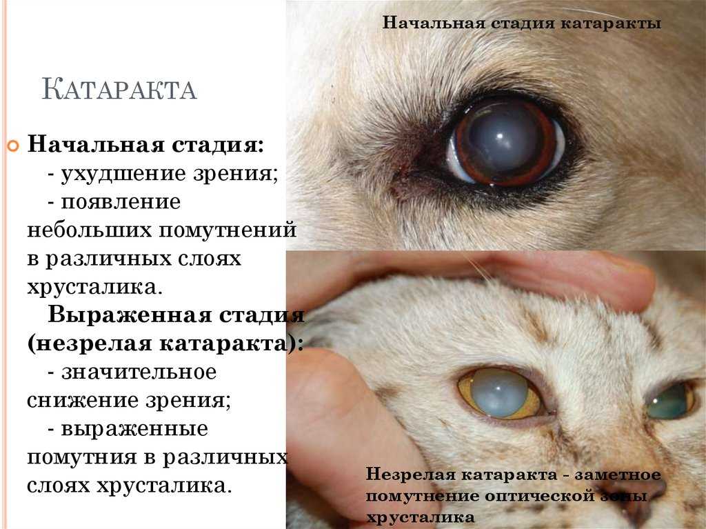 Открытоугольная глаукома