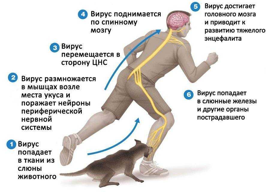 Что такое спондилез: основные причины и лечение