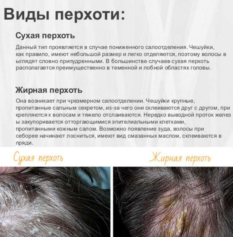 Перхоть у собаки: причины и лечение