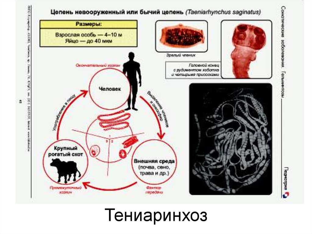 Симптомы цепня у человека. Свиной цепень жизненный цикл Taenia solium. Тениоз (свиной цепень), тениаринхоз (бычий цепень).. Тениаринхоз пути заражения человека. Стадия жизненного цикла бычьего цепня инвазионная для человека.