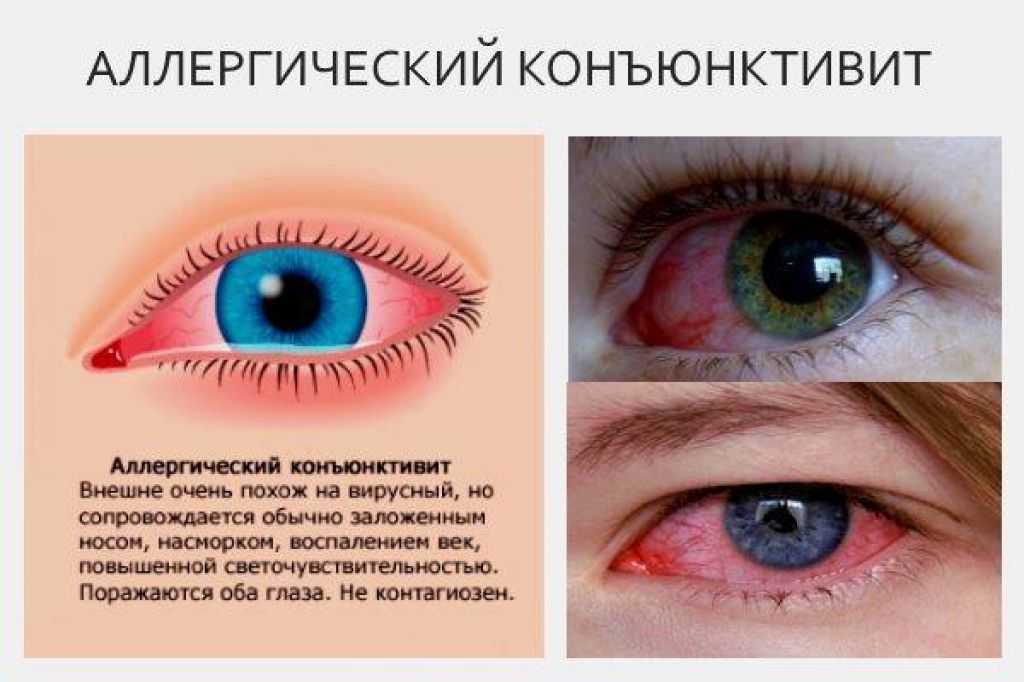 Конъюнктивит у собак