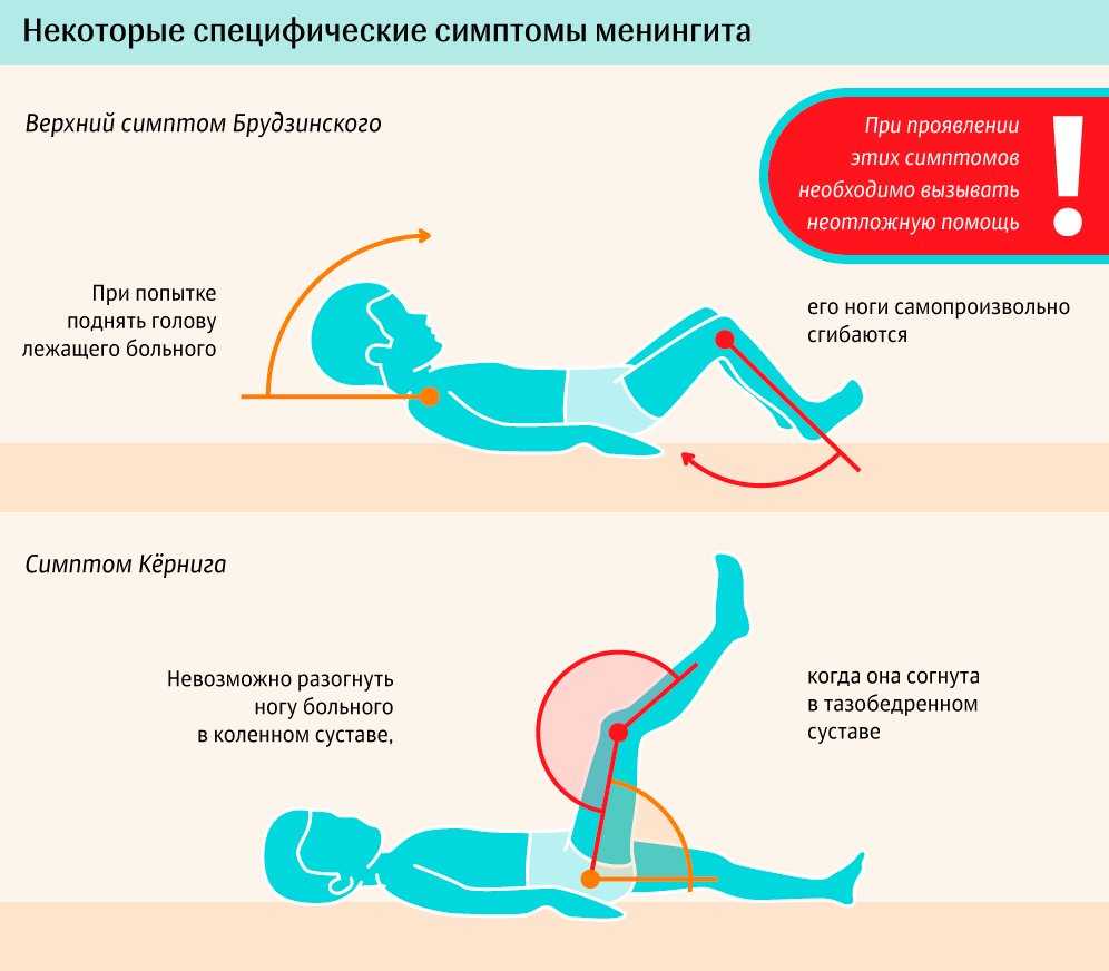 Вирусный менингит симптомы у взрослых