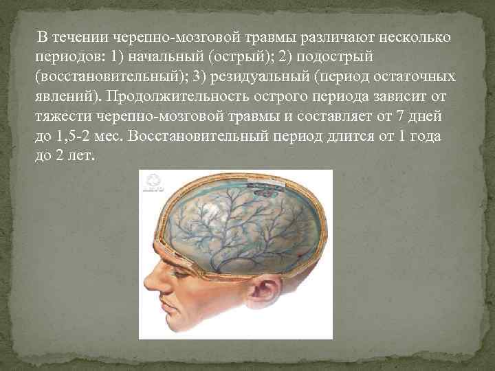 Сотрясение мозга