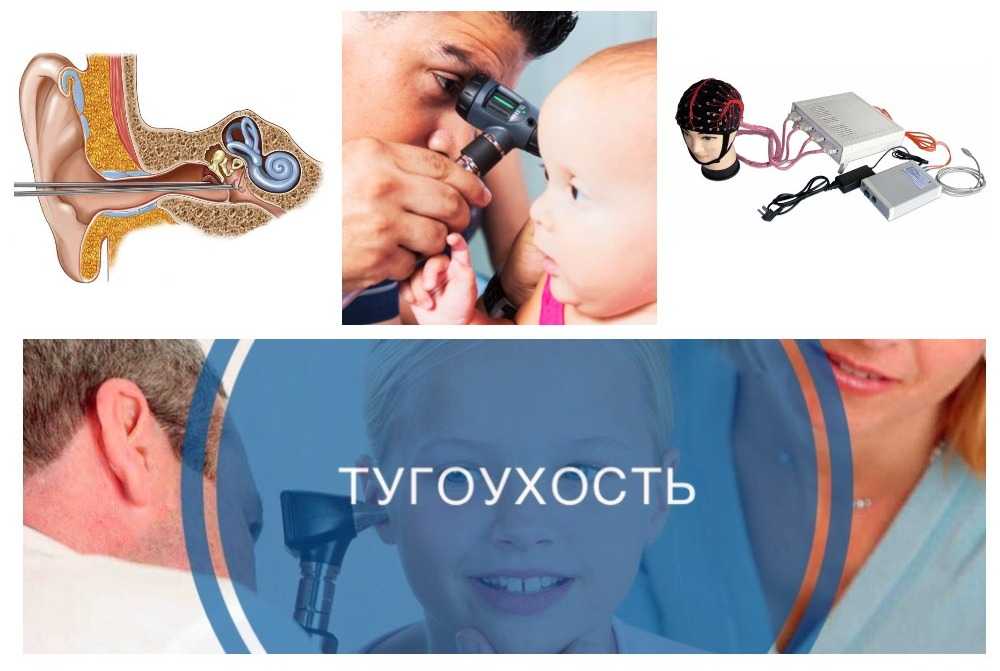 Уход за глухой кошкой