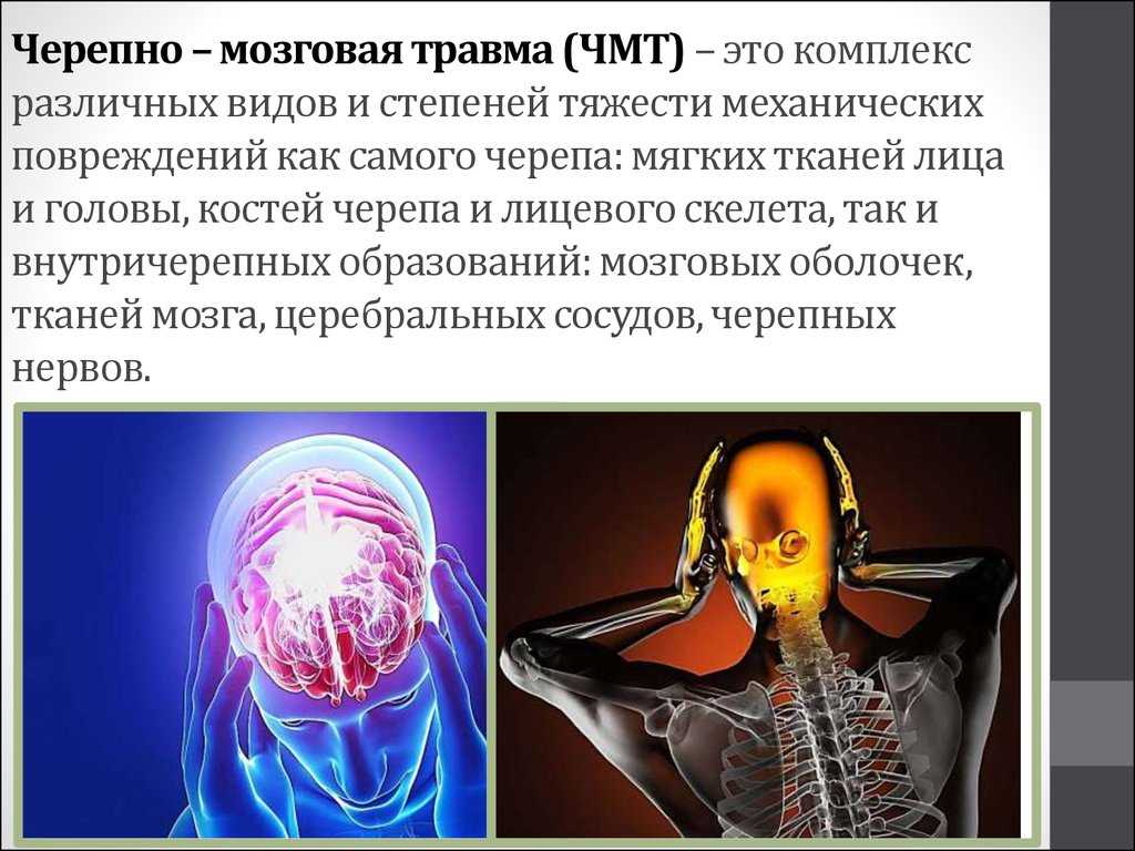 Органическое повреждение головного мозга. Классификация черепно-мозговой травмы. Открытая черепно-мозговая травма классификация. Классификация черепно-мозговой травмы подразделяется на:. Мозговая бомба.