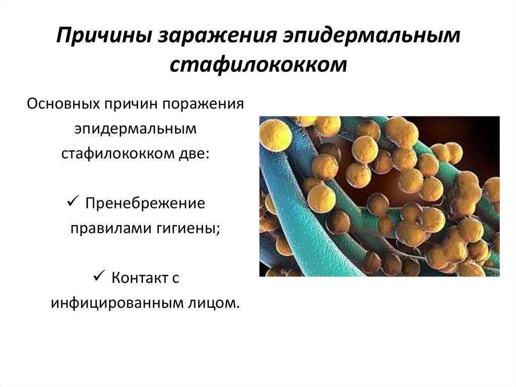 Стафилококк у кошек: от чего возникает и как проявляется