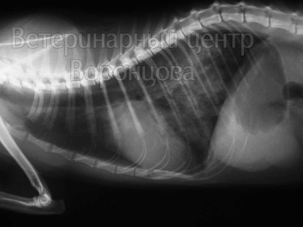 Отек легких | симптомы | диагностика | лечение - docdoc.ru