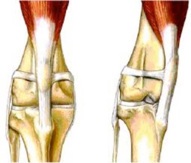 Коленная связка у собак. Вывих надколенника у собак. Медиальный вывих коленной чашечки. Медиальный вывих надколенника у собаки. Пателла коленного сустава собаки.