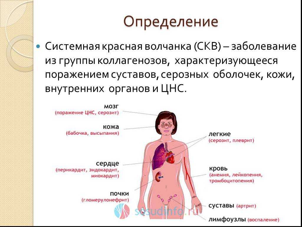 Красная волчанка симптомы анализ крови показатели лечение фото у женщин