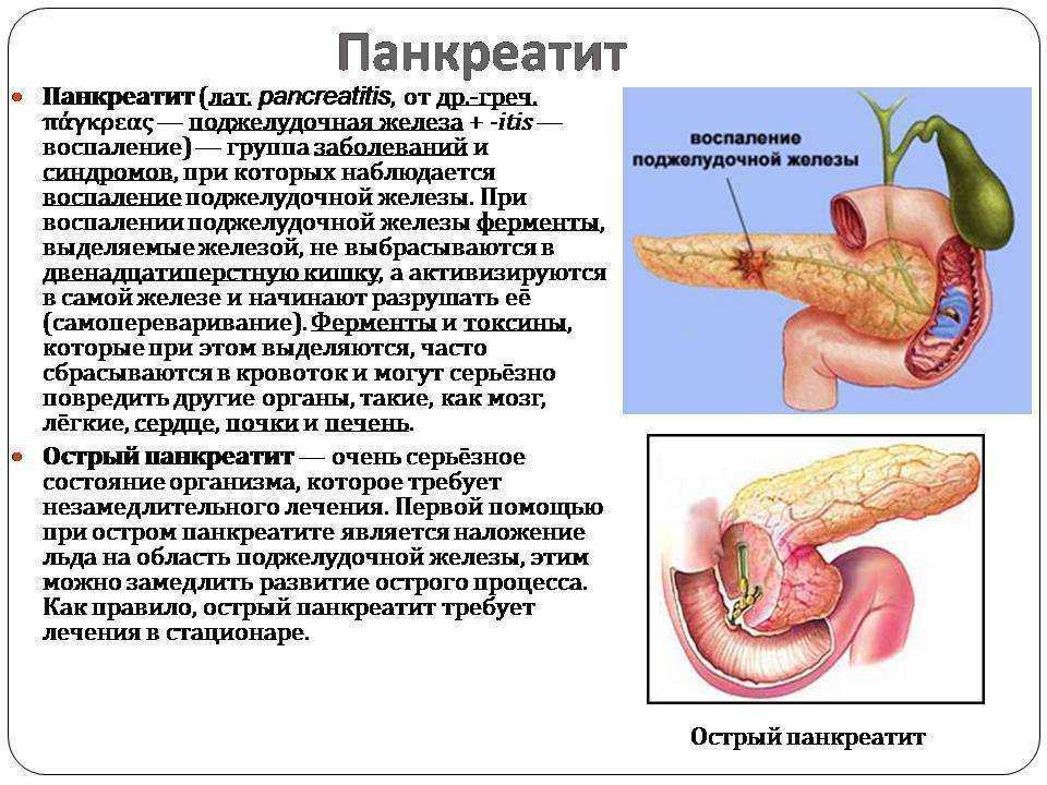 Панкреатит — что вызывает это заболевание? как его диагностировать и лечить? часть 1
