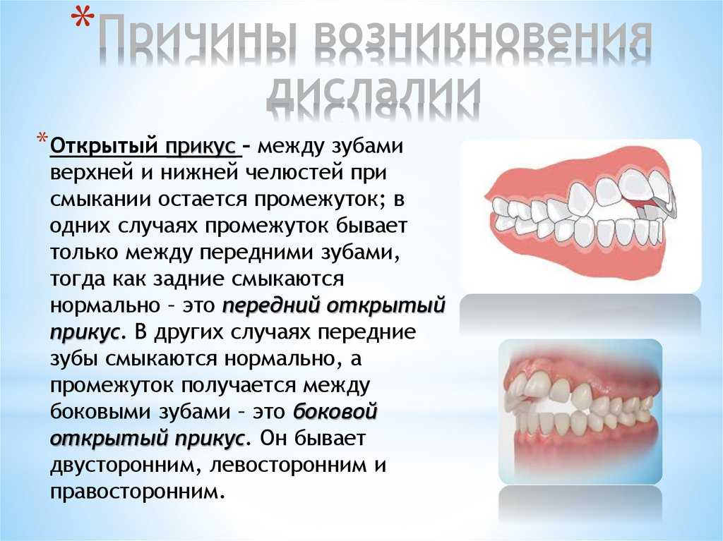 Зубы и прикус