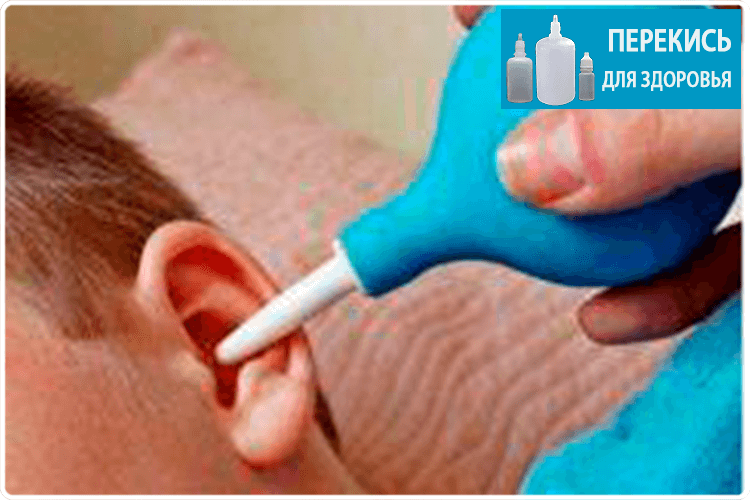 Почистить уши перекисью водорода в домашних условиях