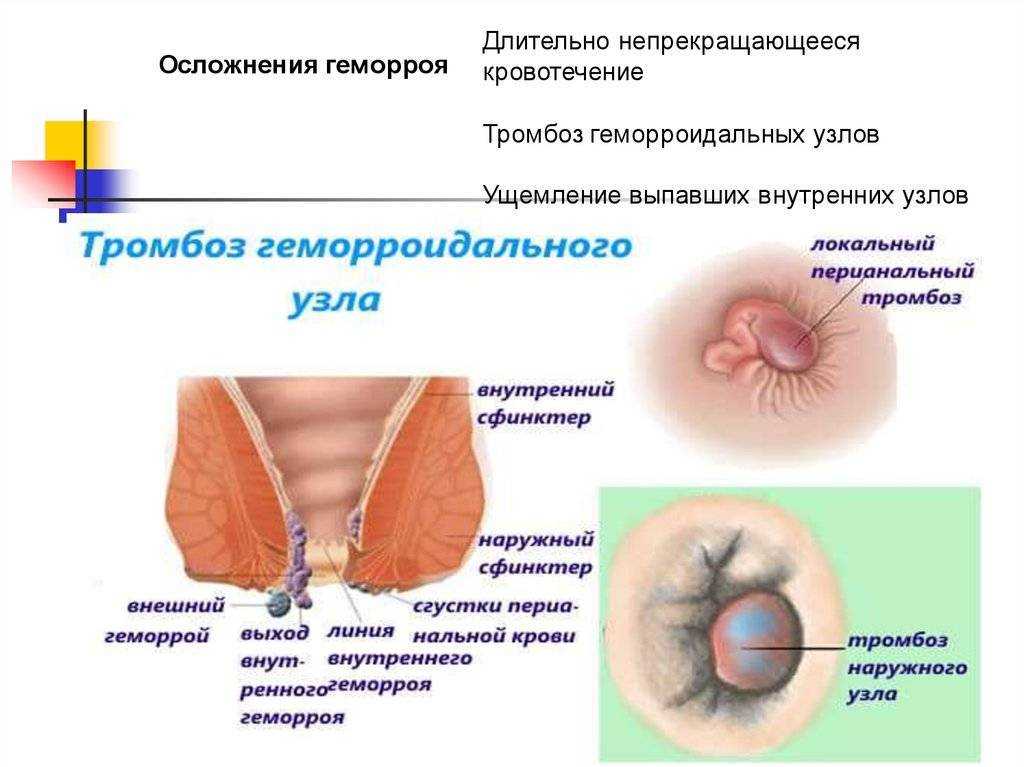 Геморрой у собак – разбираемся с деликатным недугом | ваши питомцы