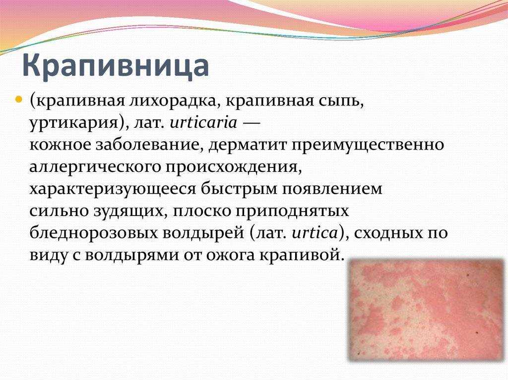 Бактериальные инфекции кожи: какие бывают, как лечить