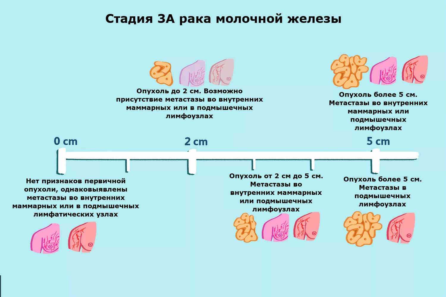 Опухоль молочных желез у кошек: лечение и прогноз