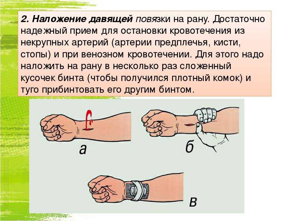 Наложение повязок при различных ранениях и кровотечениях презентация